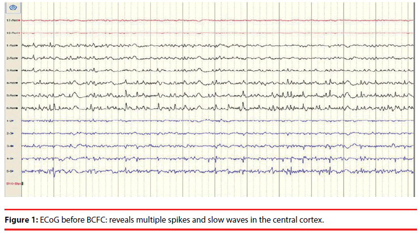 neuropsychiatry-central-cortex