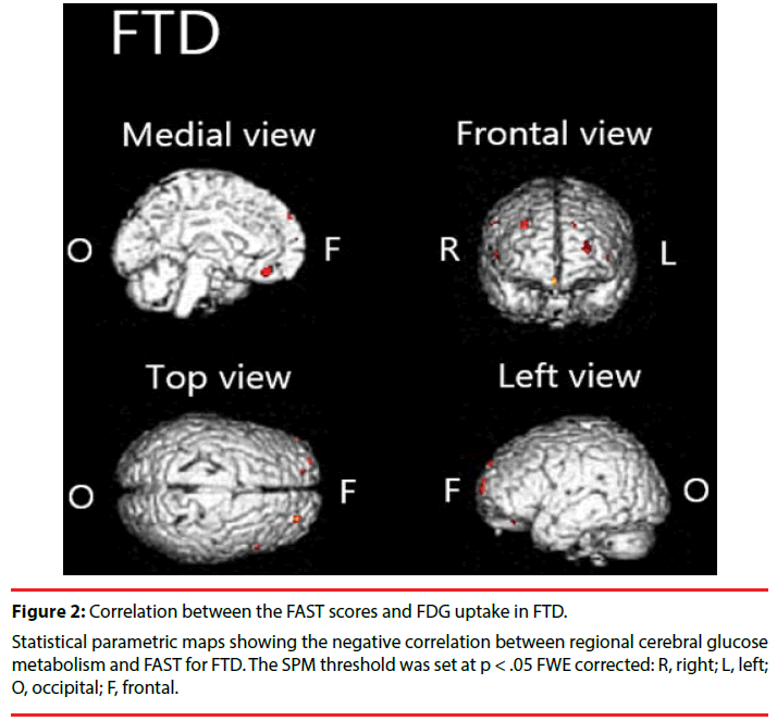 neuropsychiatry-cerebral-glucose