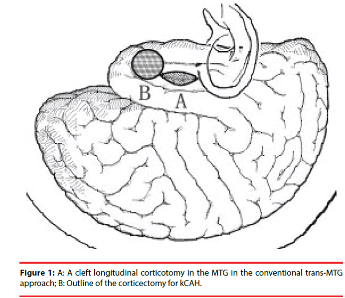 neuropsychiatry-cleft-longitudinal