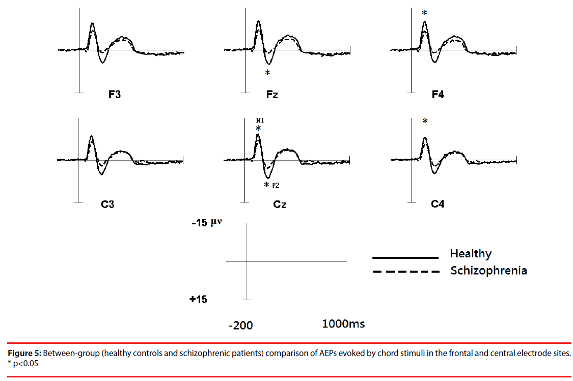 neuropsychiatry-comparison-AEPs