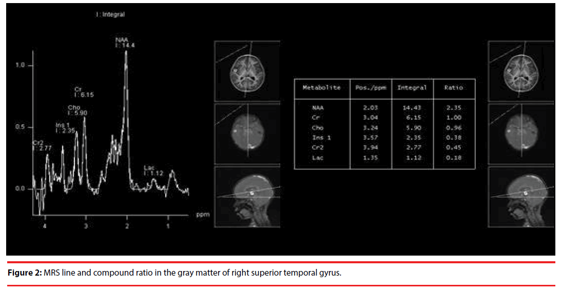 neuropsychiatry-compound-ratio