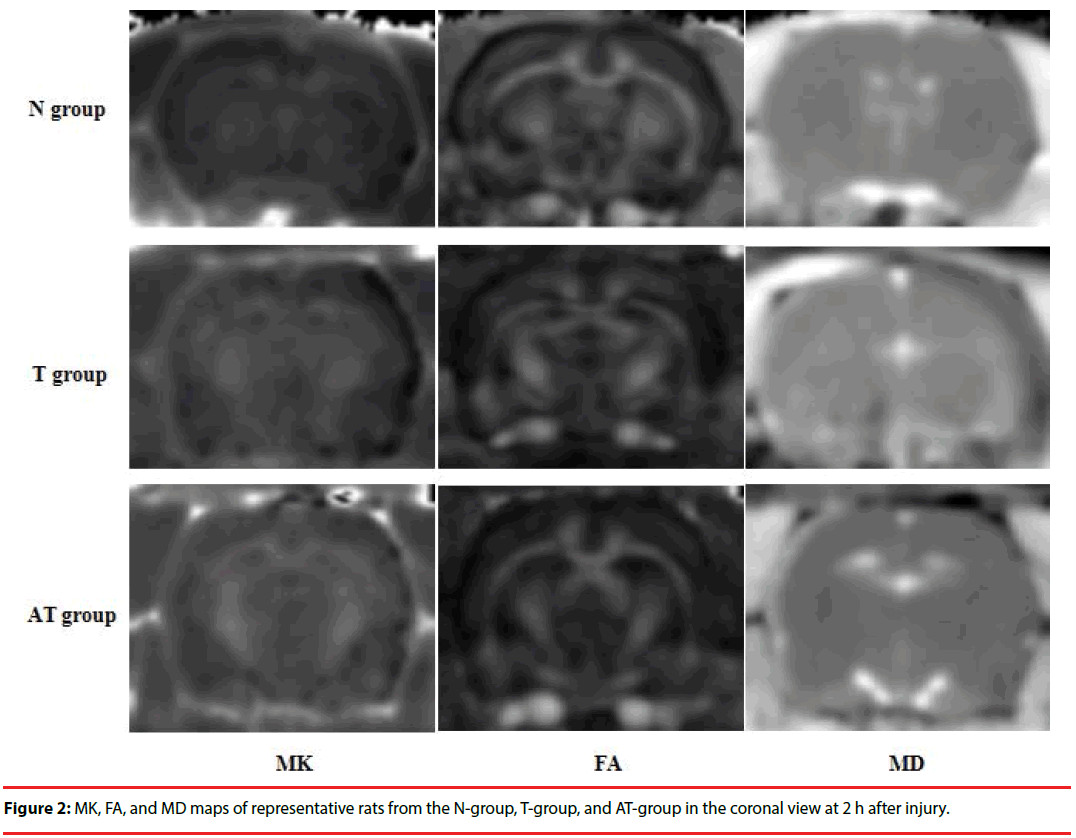 neuropsychiatry-coronal-view