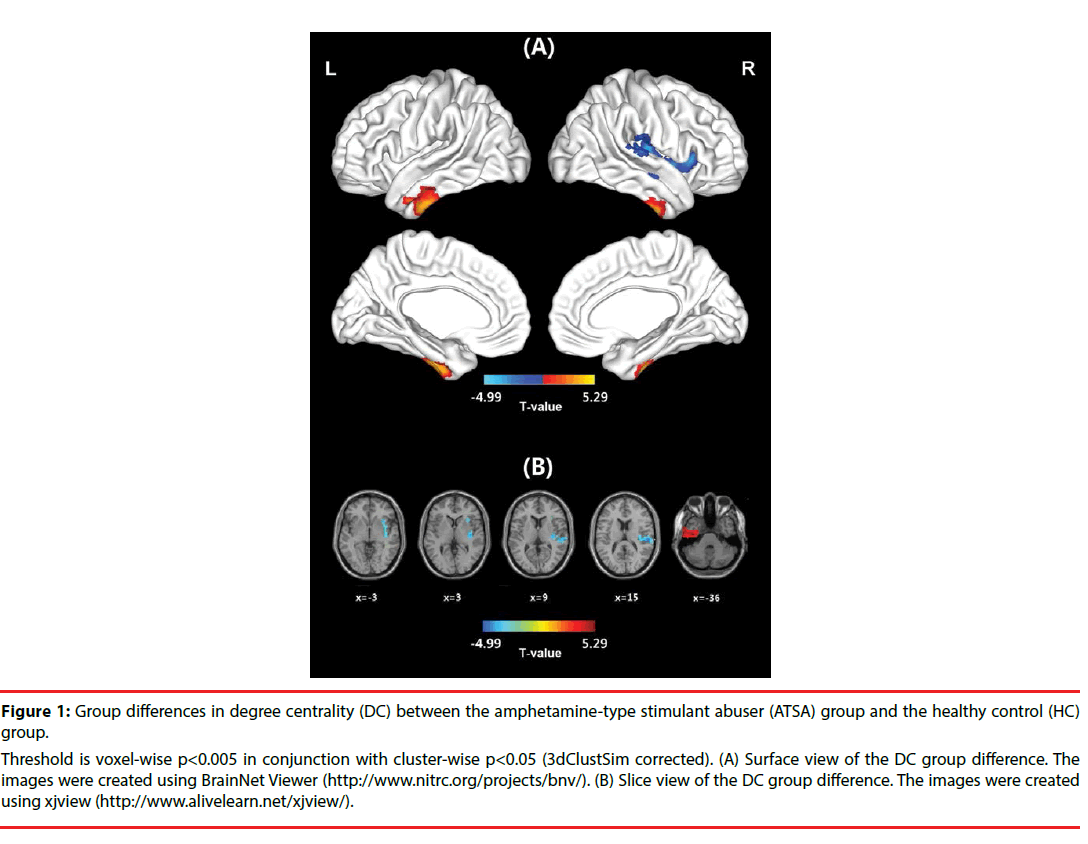 neuropsychiatry-degree-centrality