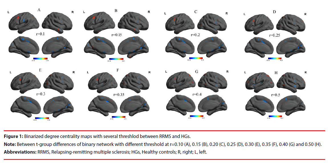 neuropsychiatry-degree-centrality