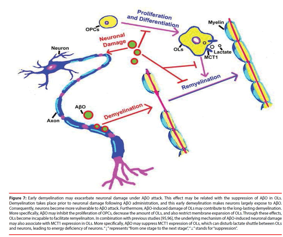 neuropsychiatry-demyelination