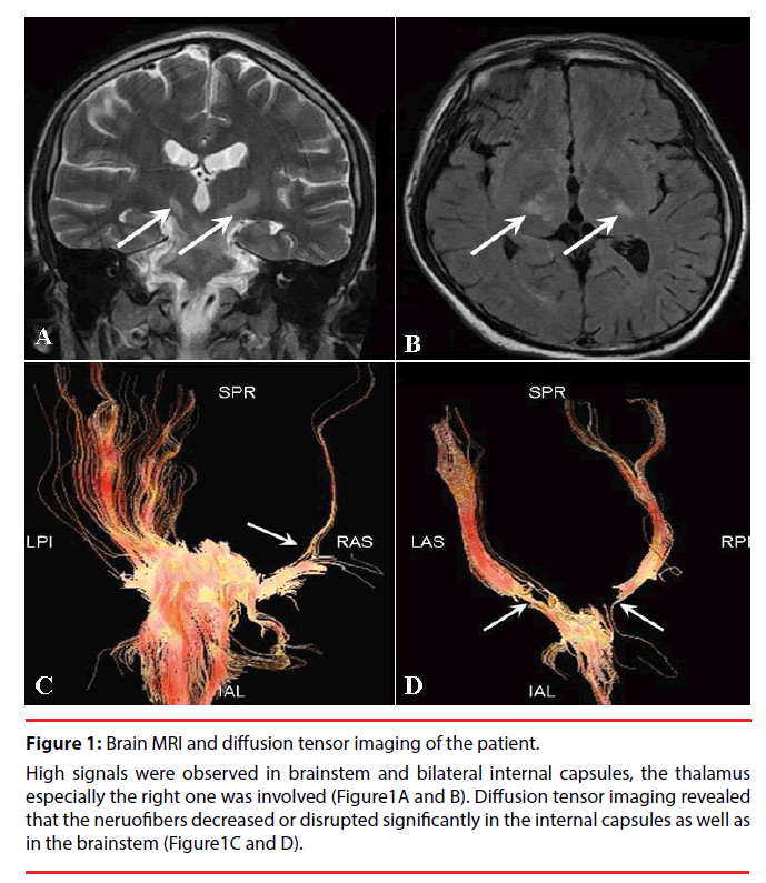 neuropsychiatry-diffusion-tensor