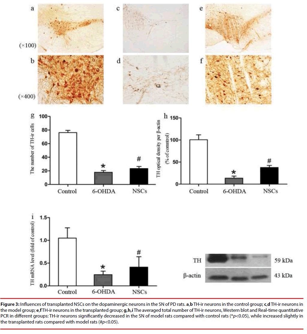 neuropsychiatry-dopaminergic-neurons