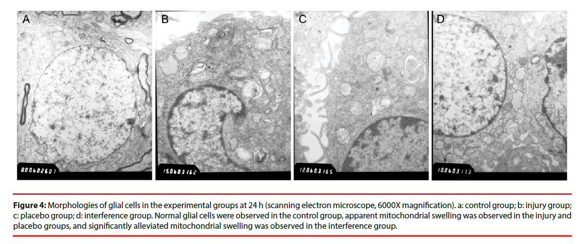 neuropsychiatry-electron-microscope
