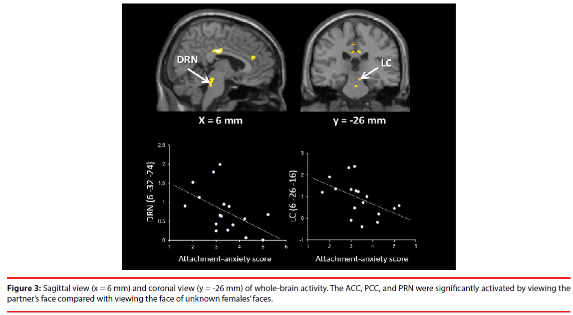 neuropsychiatry-females-face