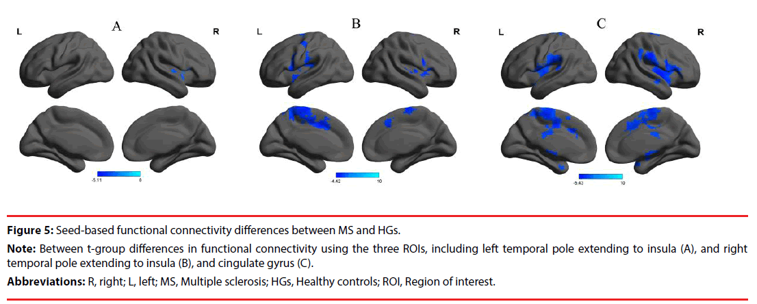 neuropsychiatry-functional-connectivity