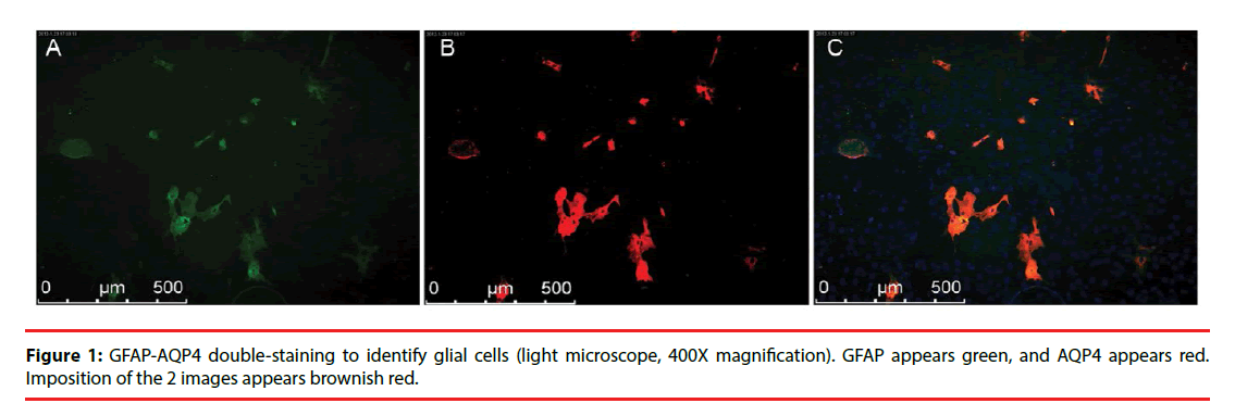 neuropsychiatry-glial-cells