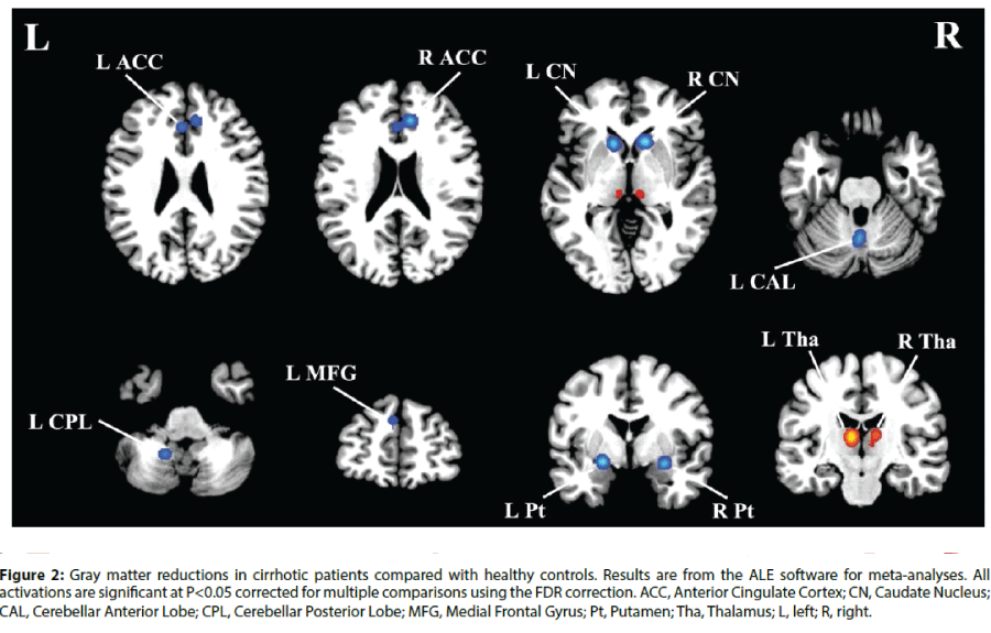 neuropsychiatry-healthy-controls