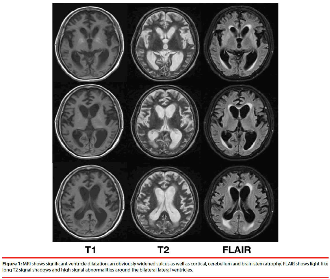 neuropsychiatry-high-signal