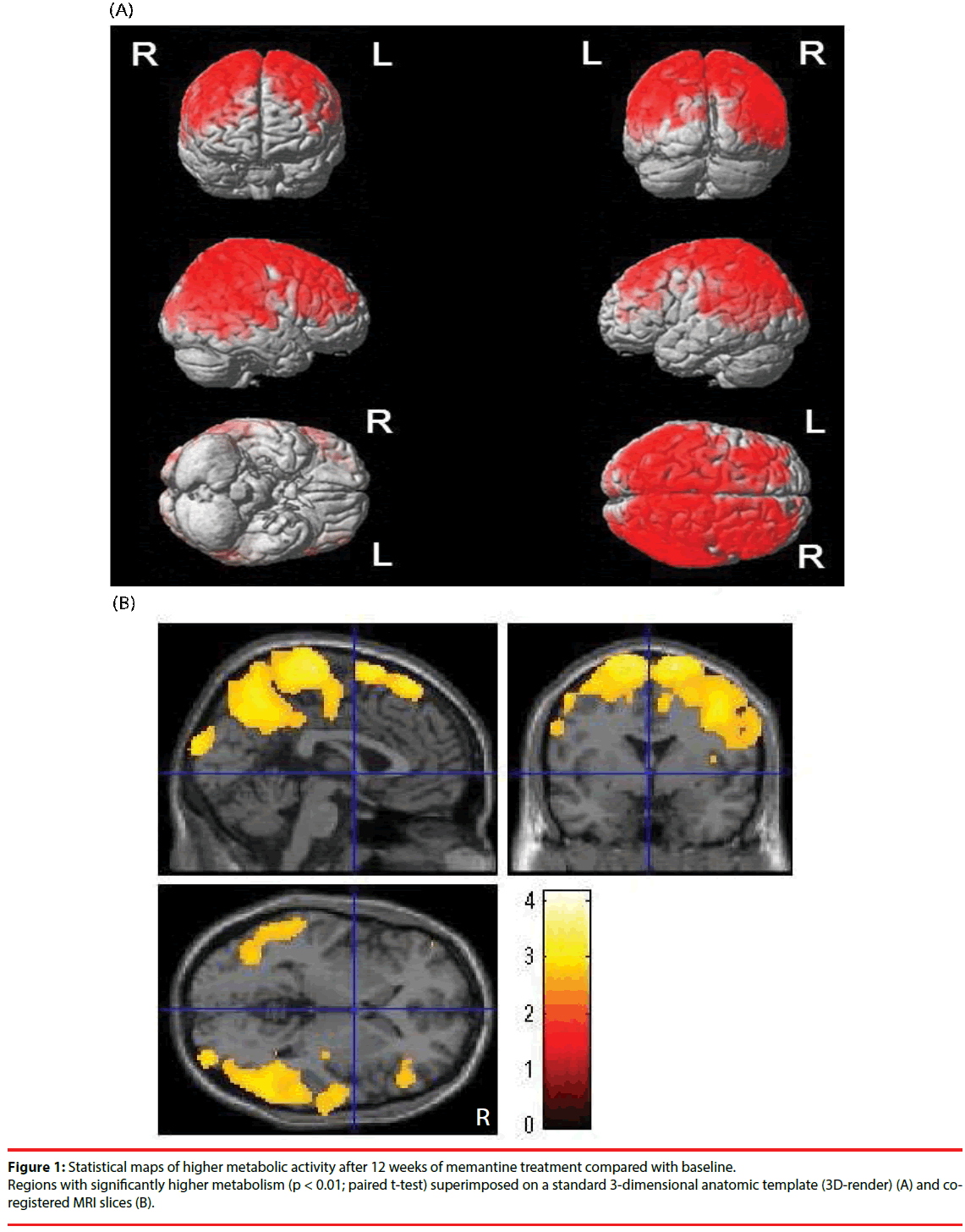 neuropsychiatry-higher-metabolic