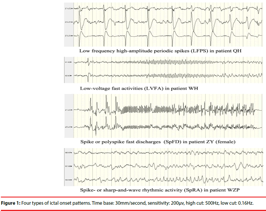 neuropsychiatry-ictal-onset-patterns