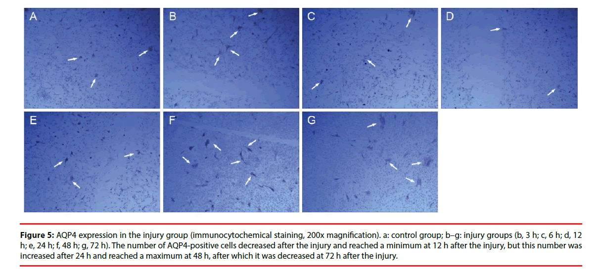 neuropsychiatry-immunocytochemical-staining