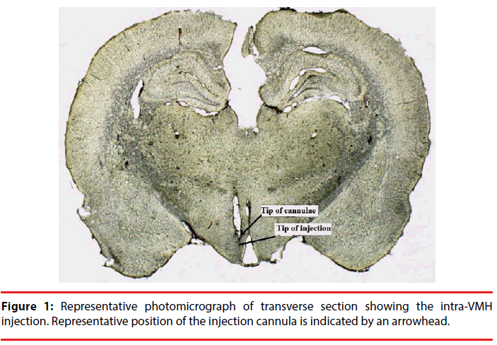 neuropsychiatry-injection-cannula