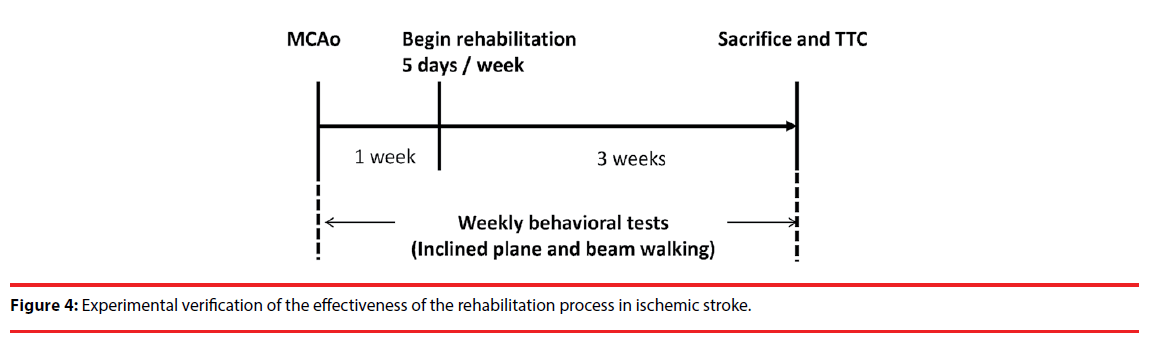 neuropsychiatry-ischemic-stroke