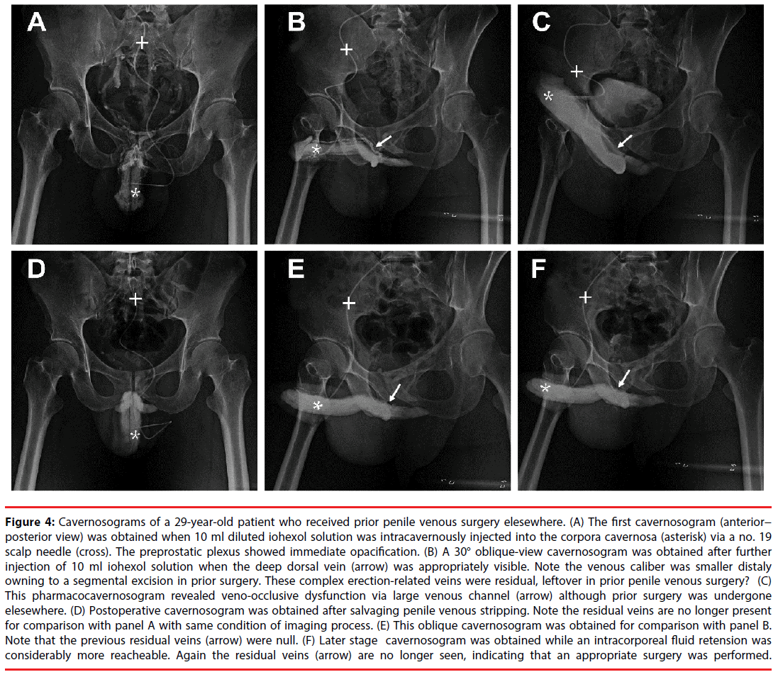 neuropsychiatry-large-venous