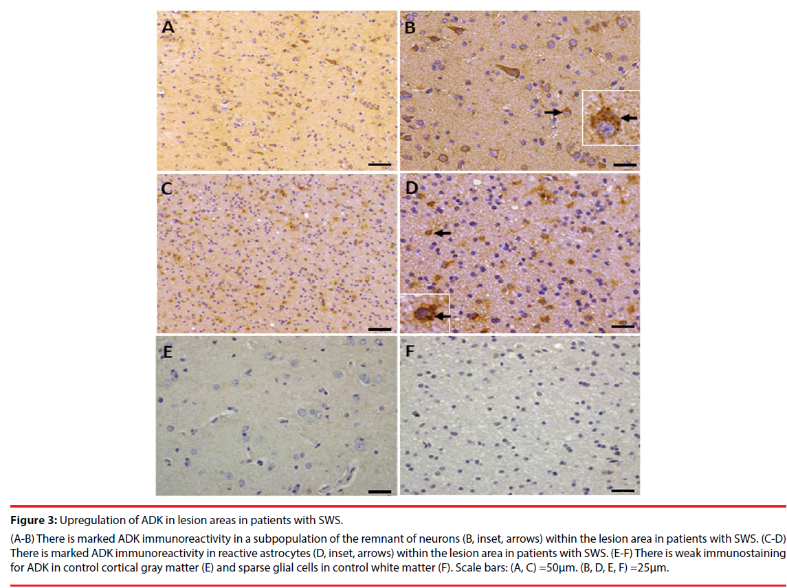 neuropsychiatry-lesion-areas