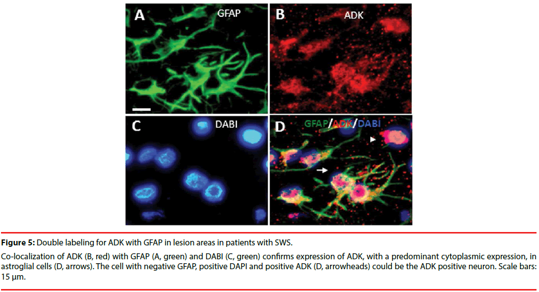 neuropsychiatry-lesion-immunoreactivity