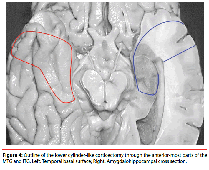 neuropsychiatry-lower-cylinder