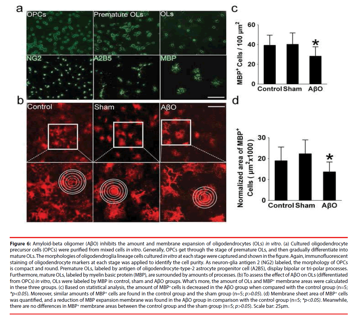 neuropsychiatry-membrane