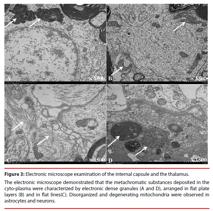 neuropsychiatry-microscope-examination