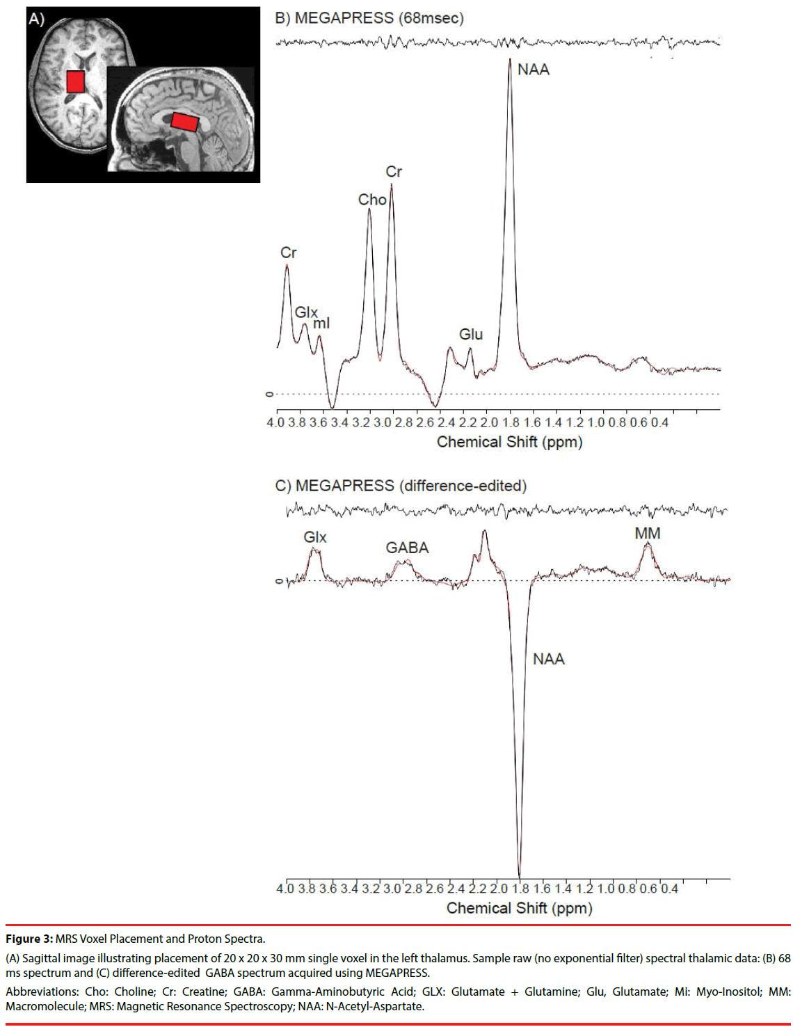 neuropsychiatry-mir-Proton-Spectra