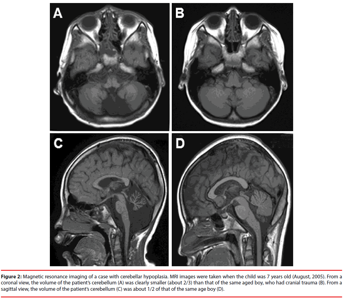 neuropsychiatry-mir-cranial-trauma