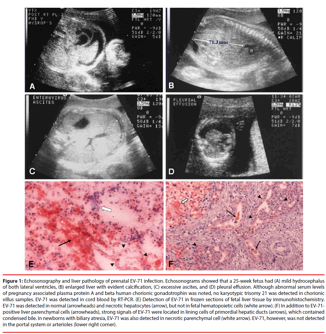 neuropsychiatry-mir-liver-pathology