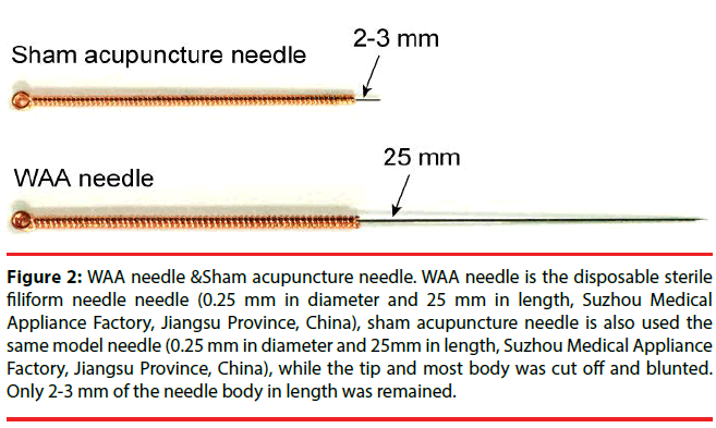 neuropsychiatry-needle-needle