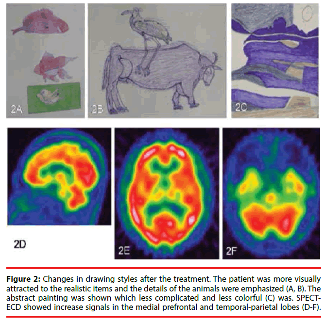 neuropsychiatry-patient-details