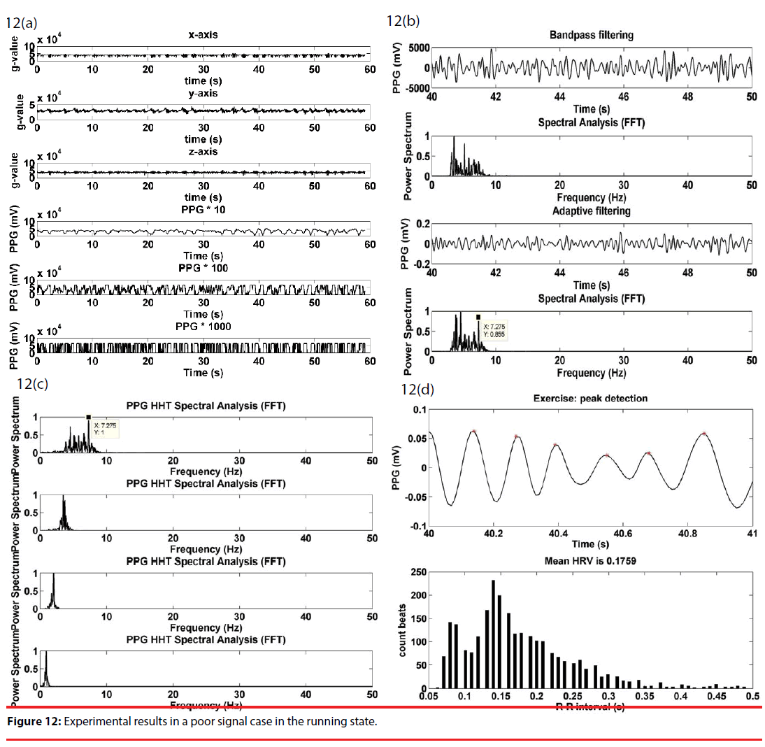 neuropsychiatry-poor-signal