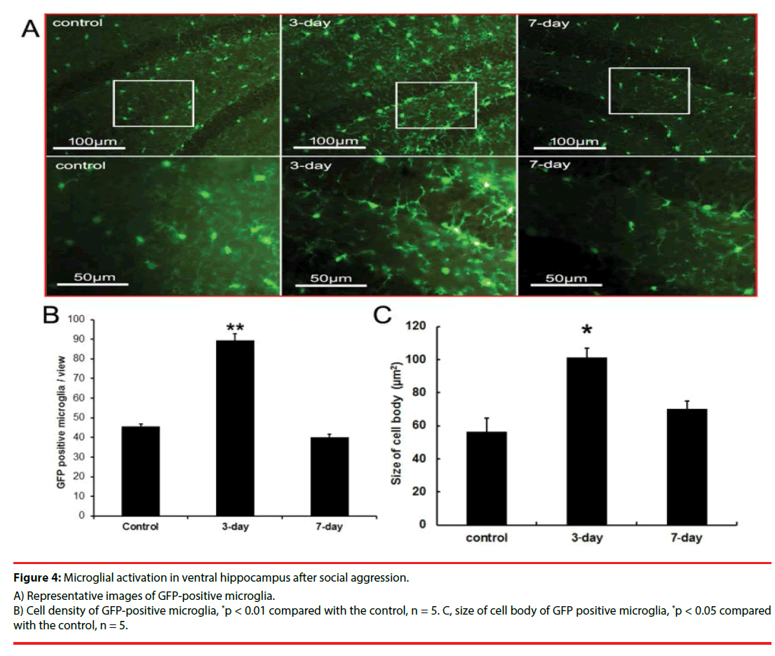 neuropsychiatry-positive-microglia