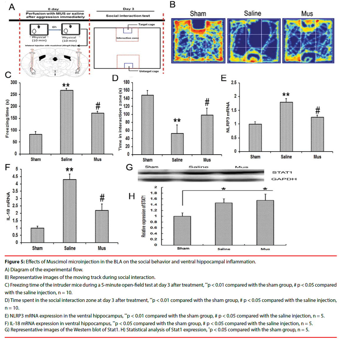 neuropsychiatry-positive-microglia