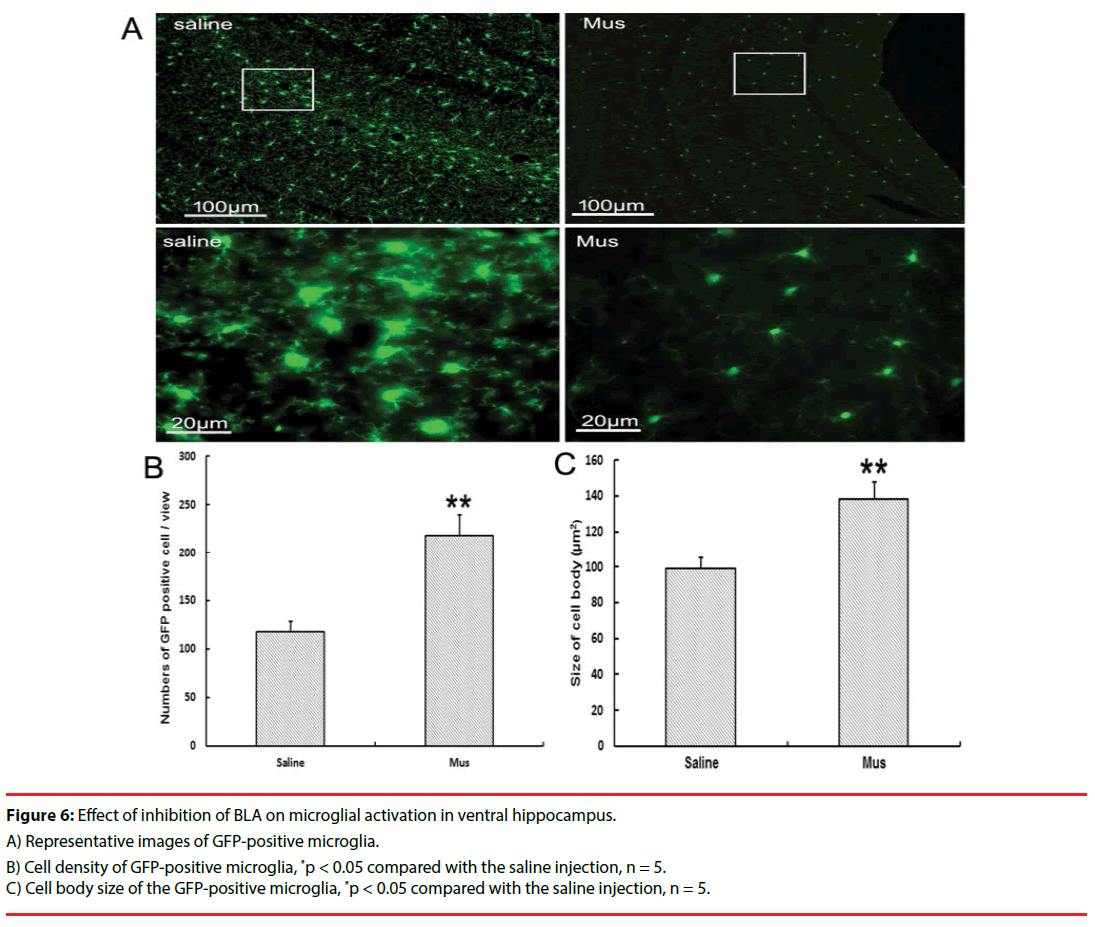 neuropsychiatry-positive-microglia