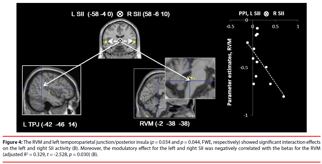 neuropsychiatry-posterior-insula