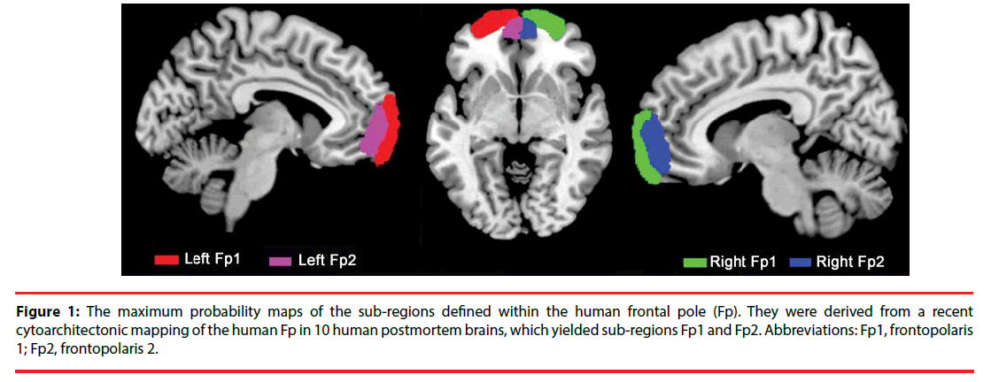 neuropsychiatry-probability-maps