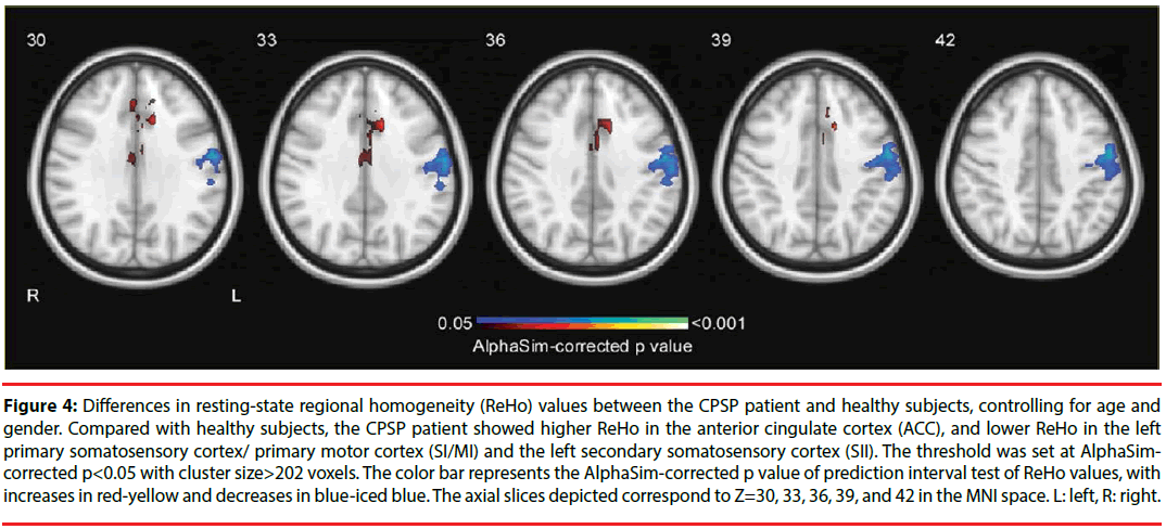 neuropsychiatry-resting-state