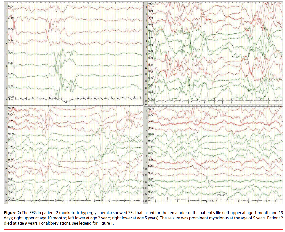 neuropsychiatry-right-lower