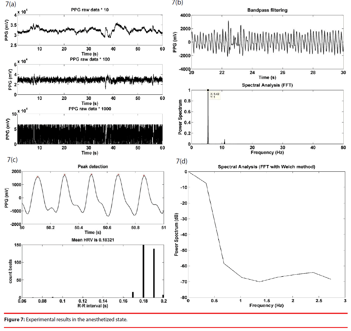 neuropsychiatry-running-states
