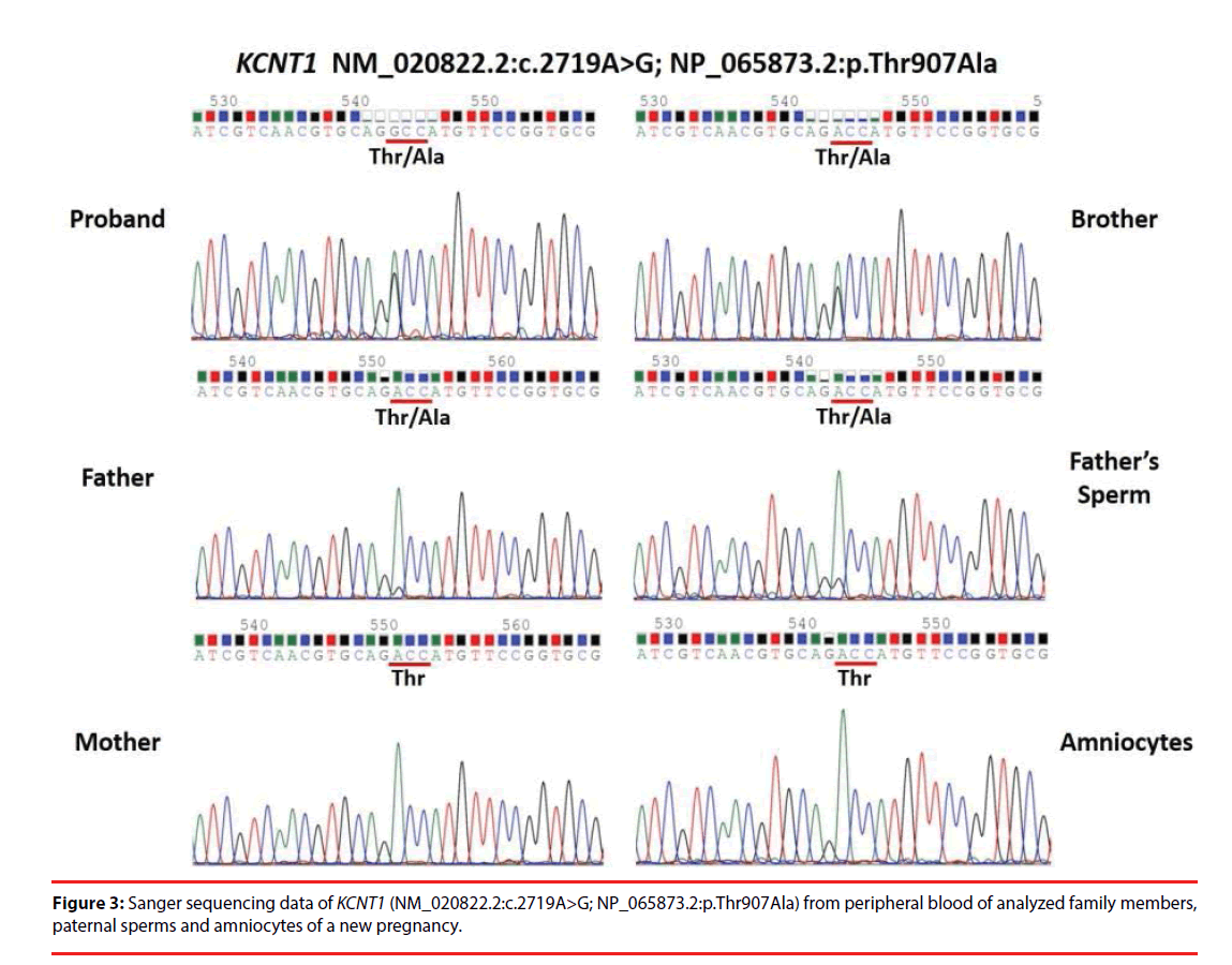 neuropsychiatry-sanger-sequencing-data