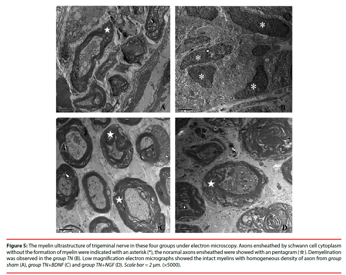 neuropsychiatry-schwann-cell