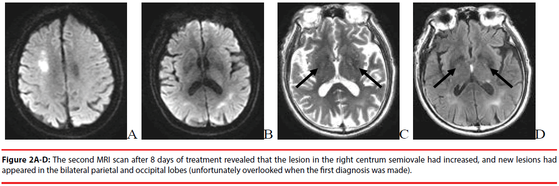 neuropsychiatry-second-scan