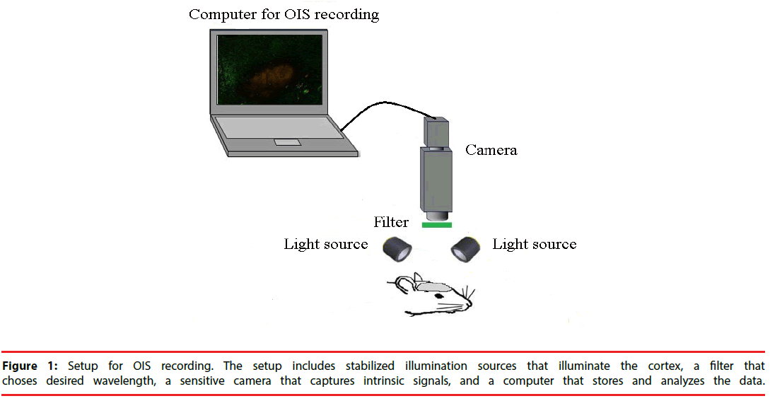 neuropsychiatry-sensitive-camera