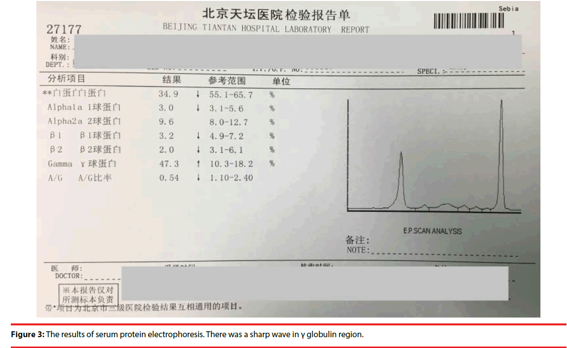 neuropsychiatry-serum-protein