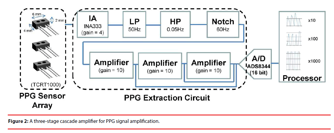neuropsychiatry-signal-amplification