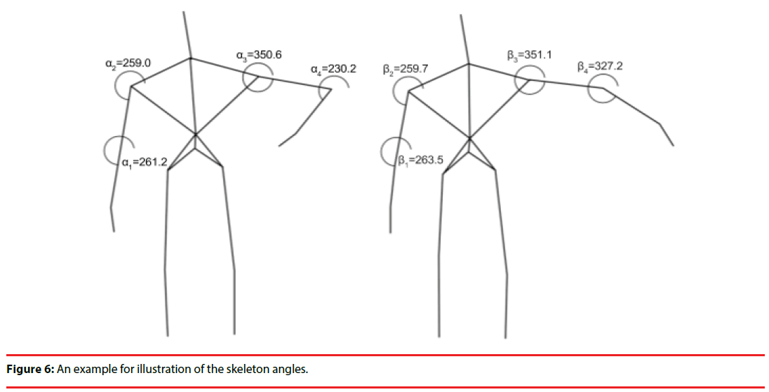 neuropsychiatry-skeleton-angles