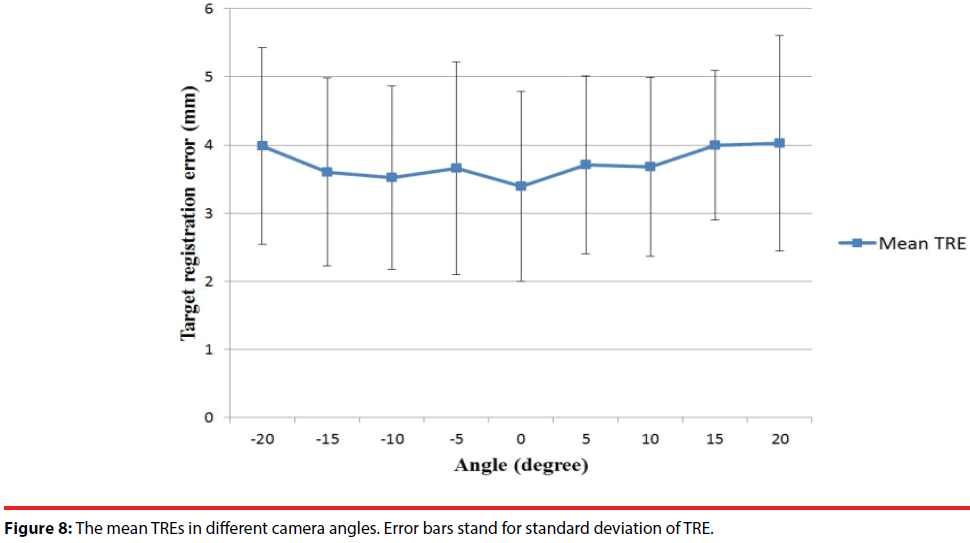 neuropsychiatry-standard-deviation-TRE